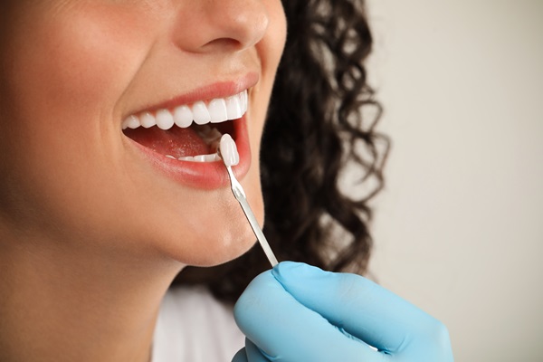 Myths And Facts About Dental Veneers